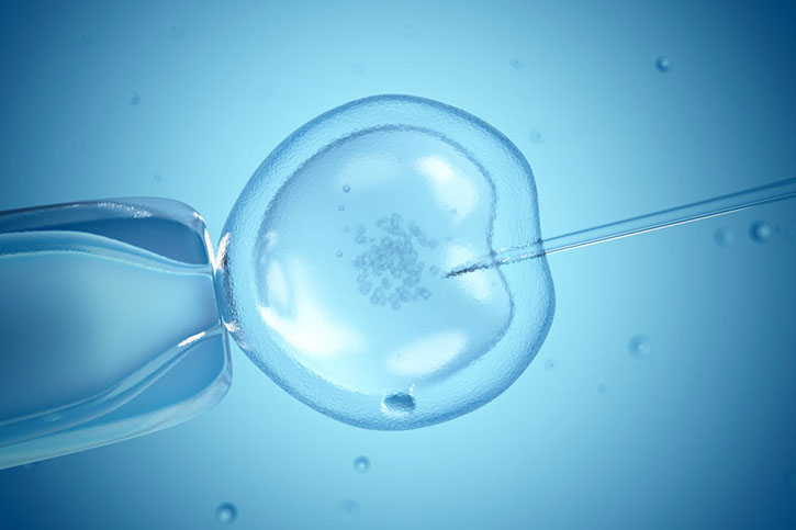 Intra Cytoplasmic Sperm Injection(ICSI)