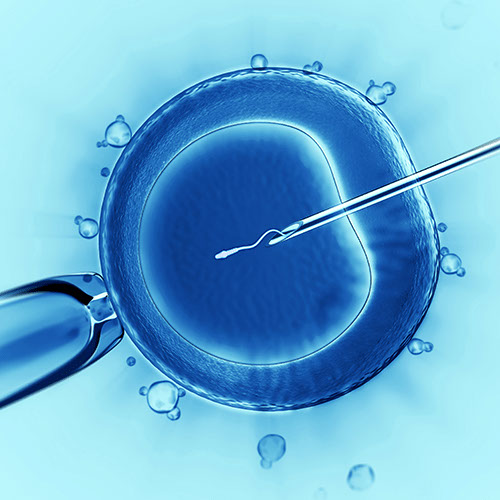 INTRACYTOPLASMIC SPERM INJECTION (ICSI)